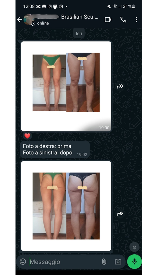 Foto di una cliente di Daniela inviate su WhatsApp: a destra prima, a sinistra dopo